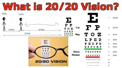 What is 20/20 Vision? - YouTube