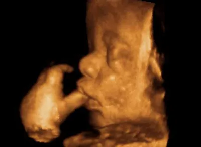 Фото УЗИ при беременности - «УЗИ при беременности - важный пункт в 9и  месячном ожидании! Мой опыт и Советы относительно 3Д узи» | отзывы