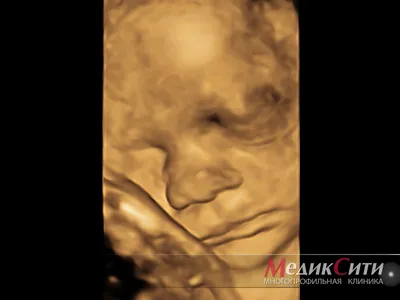 2-ое УЗИ при беременности : что смотрят и чего ожидать | It' s My  Lifestorys | Дзен