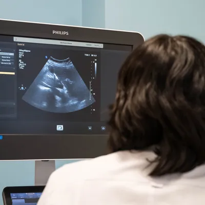 УЗИ 3D и 4D во время беременности в Краснодаре