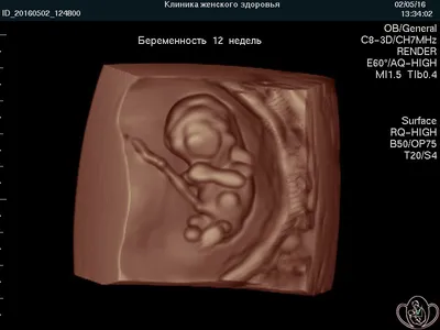 3D УЗИ и 25 недель — 2 ответов | форум Babyblog