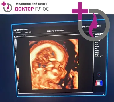 Когда делать 3D-4D УЗИ ⁉️ Я расскажу... - УЗИ-студия Dr.Di | Facebook