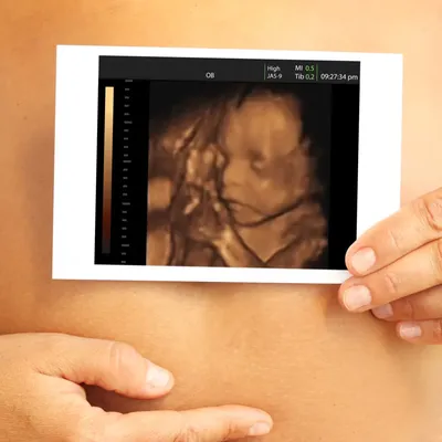 3D/4D УЗИ плода при беременности и органов в Твери