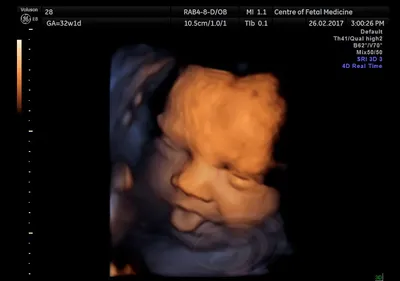 3D УЗИ, 30 недель беременности. Клиника \"АБИА\" - YouTube