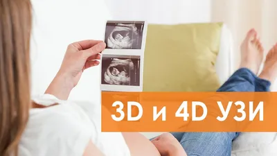 3D-5D-УЗИ при беременности: как увидеть малыша до рождения