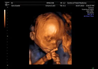 3D-4D УЗИ при беременности в Москве, сделать УЗИ беременный по доступной  цене — запись на ультразвуковое исследование внутренних органов