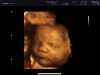 3D / 4D УЗИ при многоплодной беременности | 3D / 4D УЗИ при многоплодной  беременности - а если маленьких пузожителей двое 👼👼 | By УЗИ 21 ВЕК |  Facebook