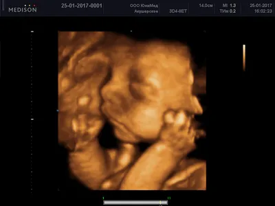 3D и 4D УЗИ при беременности: как получить фото и видео с ребёнком до родов  | Сеть клиник «Здоровье»