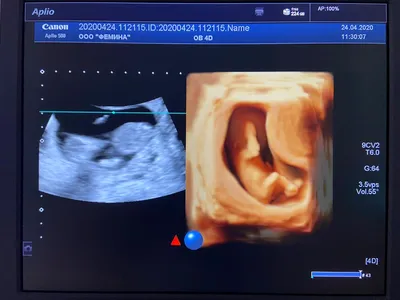 Малыш в 30 недель беременности на 3D-4D УЗИ 😃 | By УЗИ 21 ВЕК | Facebook