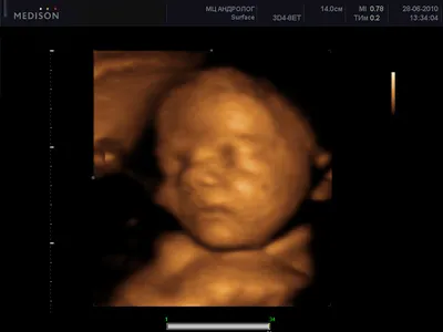 3D / 4D УЗИ при многоплодной беременности | 3D / 4D УЗИ при многоплодной  беременности - а если маленьких пузожителей двое 👼👼 | By УЗИ 21 ВЕК |  Facebook