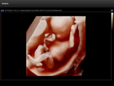 4D УЗИ,Наш малыш на 32 неделе беременности. - YouTube