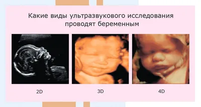 4D-УЗИ или первая видеозапись вашего малыша