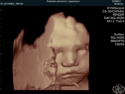 3D-4D УЗИ при беременности в Москве, сделать УЗИ беременный по доступной  цене — запись на ультразвуковое исследование внутренних органов