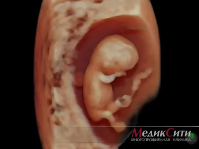 Определение ПОЛА ребенка по крови матери, с 9 недели беременности с  ТОЧНОСТЬЮ до 99%. Проверено лично. Безопасно. | Многодетная Мать с улыбкой  ;) | Дзен