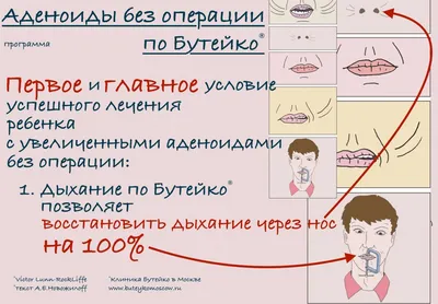 Аденоиды - причины появления, симптомы заболевания, диагностика и способы  лечения