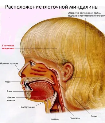 Аденоиды у детей: симптомы по стадиям развития. Лечение аденоидов у ребенка  в Москве. Аденоидит и его лечение.