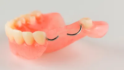 Съемные зубные протезы в Ижевске | Клиника Биктиных
