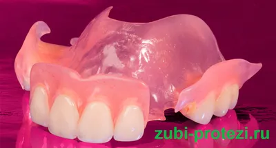 Съемные зубные протезы - 1ая Социальная стоматология
