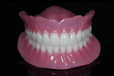 Протезирование зубов с помощью акриловых протезов | Стоматология Улыбка