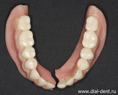 Съемные зубные протезы: за и против – стоматология ПрезиДЕНТ