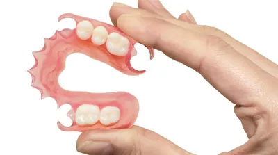 Акриловые зубные протезы: плюсы и минусы | Стоматологическая клиника  32Dent, Киев