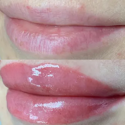 Акварельные губы фото до и после фотографии