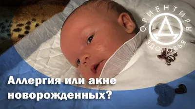 Аллергическая сыпь у новорожденного: причины, симптомы и лечение