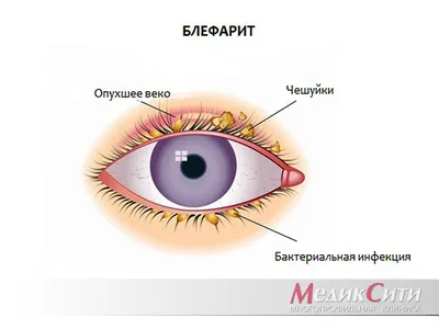 Мазь URSAPHARM Глазная Декса - Гентамицин - «Лечение застарелого ячменя у  ребенка 5 лет Не помогло. » | отзывы