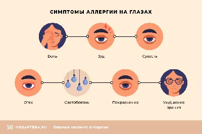 Блефарит: симптомы и лечение. Виды блефарита