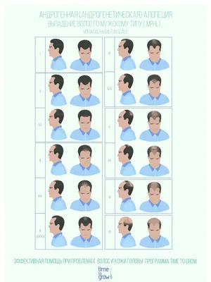 Лечение выпадения волос у мужчин женщин народными средствами в клинике  Дельтаклиник