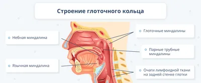 Ангина. Лечение ангины. - Феникс