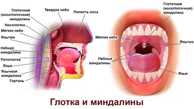Ангина у взрослых: первые признаки и симптомы, как и чем лечить?