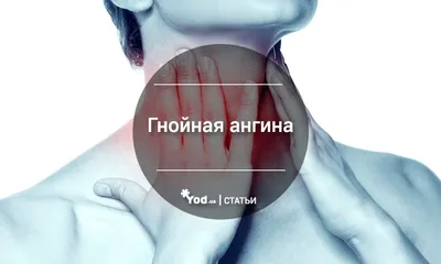 Ангина у детей. Как лечить ангину у ребенка? - статьи от компании Еламед