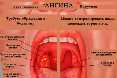 Ангина: истории из жизни, советы, новости, юмор и картинки — Все посты,  страница 8 | Пикабу