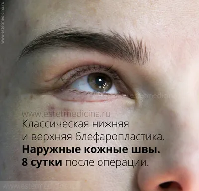 Салиджанов Анвар Шухратович – пластический хирург – 6 отзывов о враче –  запись на приём в Москве – Zoon.ru