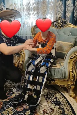 Аппарат на нижние конечности и туловище Allard S.W.A.S.H Orthosis - Thigh  Cuffs: ортопедические фиксаторы для новорожденных от \"OOO \"Рехаб Эксперт\" -  Медицинское Оборудование для Клиник и Реабилитации Пациента\"  +380-66-000-60-06, +380-503-320-320,