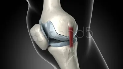 Центры боли в коленях при артрите