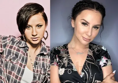 Российские известные личности до и после пластики - Блог проекта OMORFIA