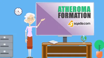 PPT — Презентация Atheroma PowerPoint, скачать бесплатно — ID:7927246