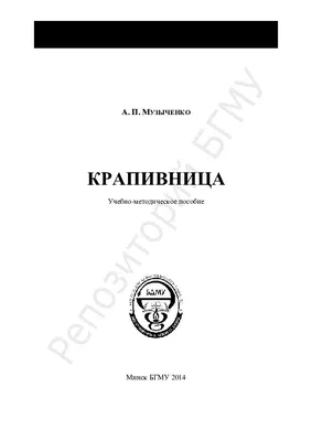 Крапивница: причины, симптомы, признаки, виды, сколько проходит, как лечить