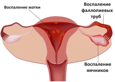 Воспалительные заболевания - Медицинский центр «На Восточной»