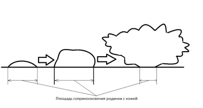 Опасны ли родинки — блог медицинского центра ОН Клиник