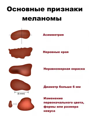 Значение родинок на теле. | Тайны Вселенной | Дзен