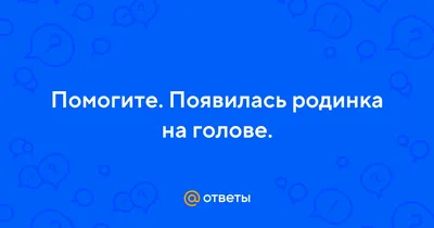 Можно ли удалять родинку на голове и когда это необходимо