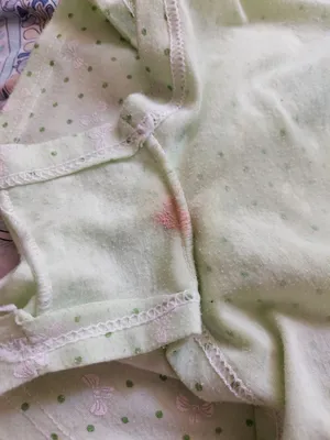 Выделения у девочки 5 месяцев — 11 ответов | форум Babyblog