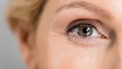 6 способов предотвратить старение кожи вокруг глаз и опущение век
