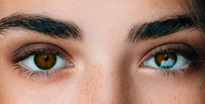 Ожог глаза: причины, виды, симптомы, диагностика и лечение ожога глаза в  Москве - сеть клиник «Ниармедик»