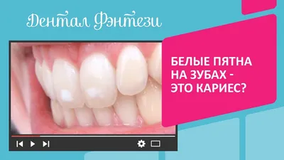 Опасны ли белые пятна на зубах?
