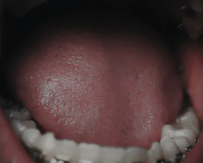 Статьи о здоровье полости рта — советы по уходу за зубами и деснами |  Dental-MM