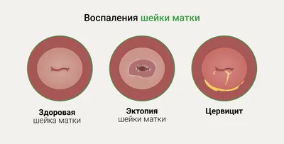 Неприятный запах в интимной зоне: причины, лечение